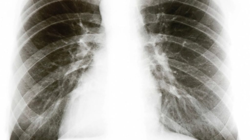 Técnico em radiologia: o que faz, curso, registro e rotina